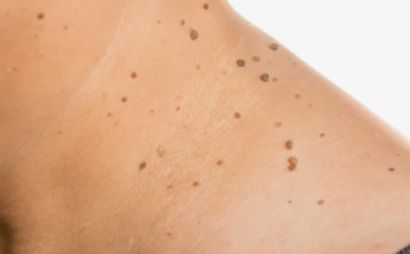 Transformasi Epidermis: Strategi Pembersihan Internal untuk Tekstur Kulit yang Sempurna